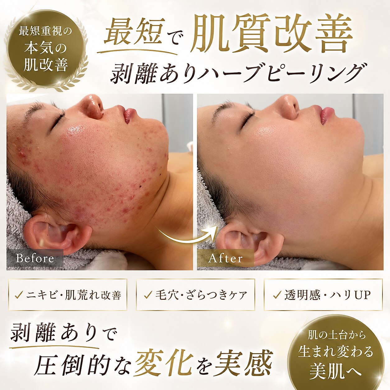 【人気No.1】肌質改善の最短ルート！ショートカットピーリング 60分￥11,000