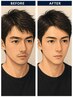 【男の身だしなみ】ひげ脱毛＋眉毛WAXセット！￥10,000