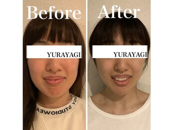 小顔屋ゆらやぎ