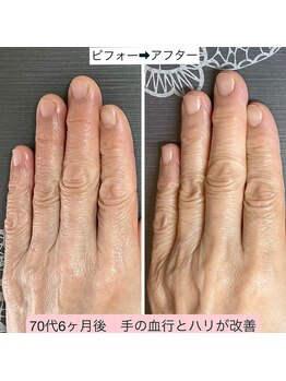 爪の健康の為のネイルサロン