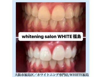 ホワイトニングサロン ホワイト(WHITE)/セルフホワイトニング/大阪/福島