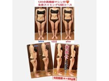 ヴィ ユニヴェール 博多店の雰囲気（【集中ダイエット】全身及びポイント部お悩みの箇所を的確に撃退）