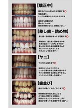 ホワイトニングショップ 岸和田店/どんな方でも一度ご相談下さい♪