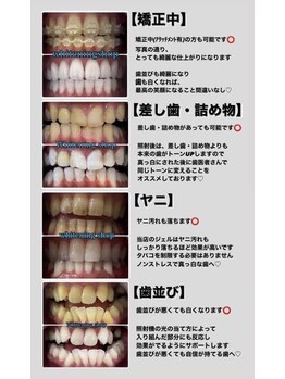 ホワイトニングショップ 岸和田店/どんな方でも一度ご相談下さい♪