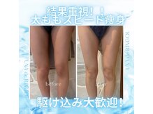 ウナ デ リンゴル 恵比寿店(UNA de Ringol)/ボディ痩身¥18,000
