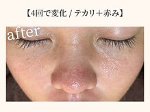 ドリームスパ 町田店(DREAM SPA)/before→after