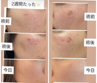 東洋経絡エステ アンド リラクゼーション