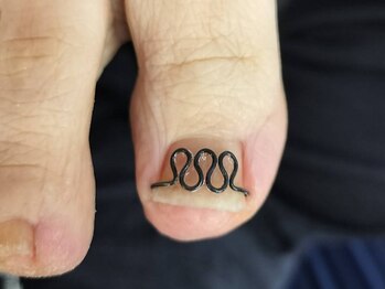 フレッシュフット(FreshFoot)の写真/【朝9:00～OK◎】【ツメフラ法】専門機関でも使用中！長年の爪のお悩みや痛みとはもうさよなら！