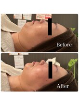 スターエステ(STAR ESTHE)/【ビフォーアフター】