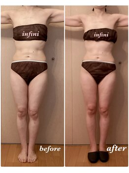 アンフィニ(infini)/短期集中コース全身3回(1ヶ月)
