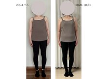 ストーリーバイスター(story by STAR)/肩回り・二の腕スッキリ