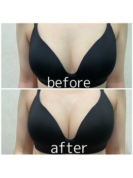 セルフライン(SELF LINE)/バストアップ