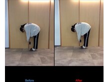 徳島藍住整骨院 ザ ビー(THE B)/ピラティス初回体験before/after