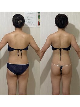 ウツク(utuku)/痩身/ブライダル/長岡市/柏崎市