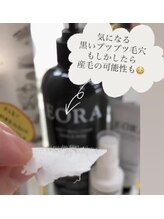 リリアージュ(Lilyage)/プツプツ毛穴産毛かも？！