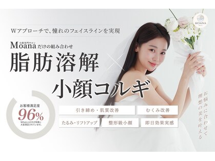 モアナ(Moana)の写真