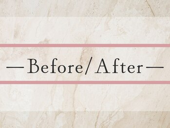 エクストリミティ 国立店(EXTREMITY)/ビフォーアフター