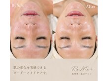 リミープラス 豊中曽根店(Re:Me+)