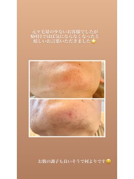 エピ リブレ(8epi.Libre)/