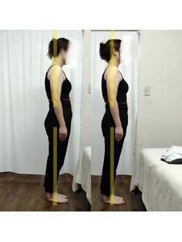 サンイチゼロ(310)/before→after