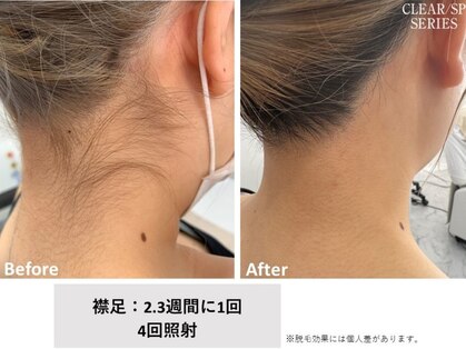 リノ(Lino)の写真