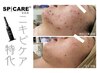 【リピート率100％ニキビケア】脂性肌の改善にも◎wax＋VOSサロンケアセット