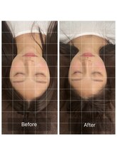 トニック バイ まつもと整骨院鍼灸院(Tonic)/★Before After★豊中／小顔