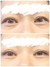 リュクシー(LUXEY)/DKL（デザインキープラッシュ）