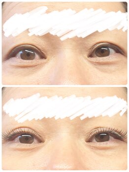 リュクシー(LUXEY)/DKL（デザインキープラッシュ）