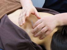 西小山弁天通り 鍼灸治療院/心身の重だるさ解消に！