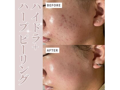 ベル(Belle)の写真