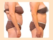 癒和(YUWA)/ポッコリお腹・お顔周りスッキリ