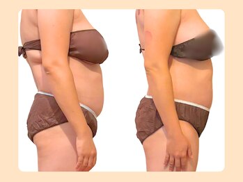 癒和(YUWA)/ポッコリお腹・お顔周りスッキリ