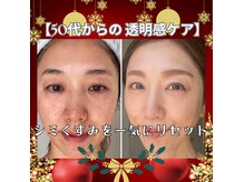 トータルエステティック ジョワイユ(JOYEUX)