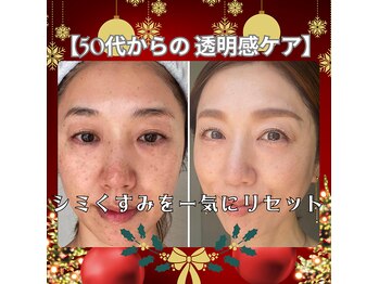 トータルエステティック ジョワイユ(JOYEUX)