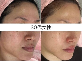 シミケア専門店 SAKURA 平塚店/【平塚/相模原/伊勢原】