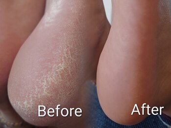 エンネイル(en.nail)/40代女性