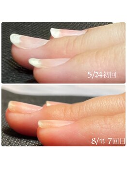 エイム(aim)/