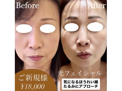 ラシェリ(Lacherie)の写真