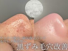 ルーナジェーナ(Luna llena)の雰囲気（フォトギャラリー・ブログでは実際の施術例を多数掲載中［池袋］）