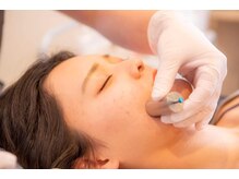 ハリッシェ(HARICHE)/広島希少★