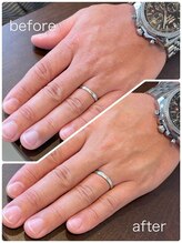 サロンドエー 帝塚山(Salon de A)/メンズネイルケア2