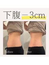 フラットベリー 恵比寿(Flat BELLY)/究極のお腹集中ケア120分