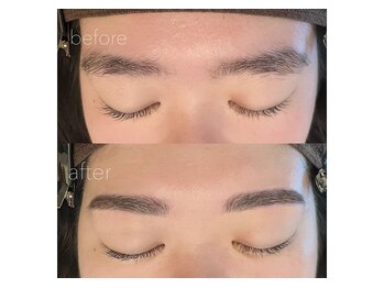 モカラ(MOKARA)/ビフォーアフター