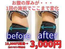 ハハハンド(HaHa-Hand)の雰囲気（お腹の厚みにサヨナラ！引き締まったお腹でメリハリボディへ♪）