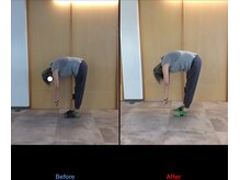 徳島藍住整骨院 ザ ビー(THE B)/ピラティス初回体験before/after