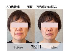 エミフル(emifull)/鏡をを見るのが嫌じゃない