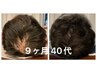 【育毛促進鍼/抜け毛/ヘッドスパ】75分 ¥13200→¥5500