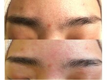 サロンドエステケイワイ(de KY)の雰囲気（電気脱毛で綺麗に完了！左右非対称や毛穴が引き締まり美肌も叶う）