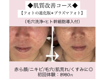エステティックサロン さらの写真
